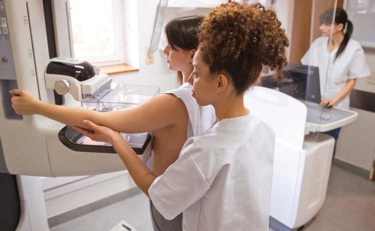 Breast cancer screening FAQ