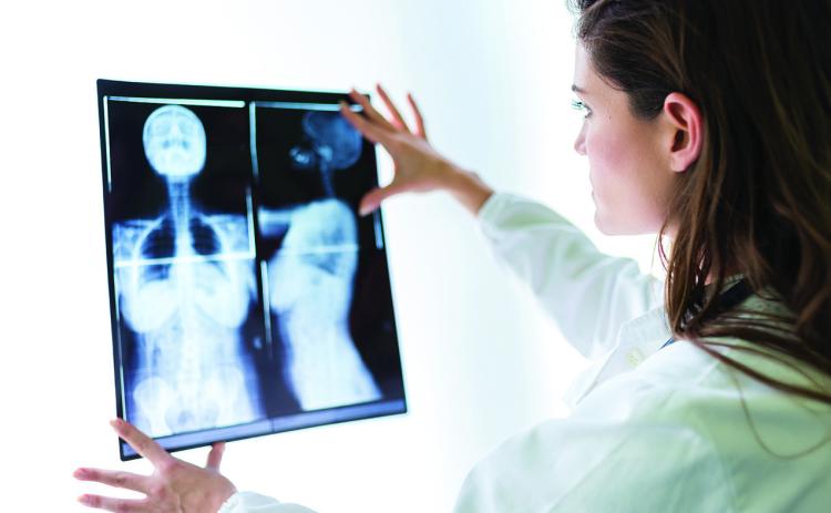 What to know about inflammatory breast cancer